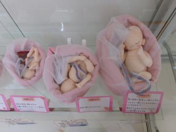 胎児モデルの写真