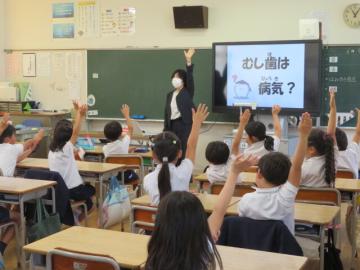 むし歯は病気ですかとたずねる歯科衛生士